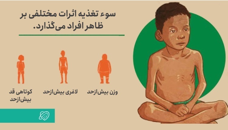 جایگاه ایران در جدول جهانی سوءتغذیه/ هشدار به ۸ استان