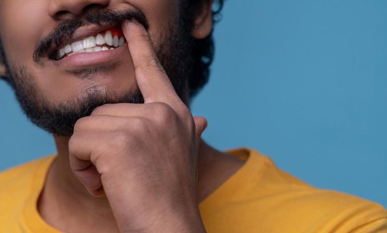 ۷ روش خانگی برای پاک کردن لکه های قهوه ای روی دندان