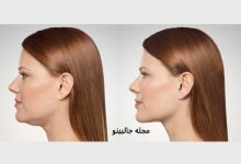 راه های از بین بردن غبغب