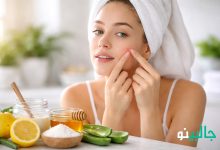 روش های فوری از بین بردن جوش